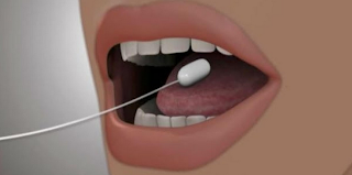 Balón Ingerible: Todo lo que necesitas saber de esta nueva técnica para adelgazar