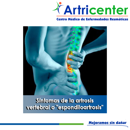 Artricenter: Síntomas de la artrosis vertebral o “espondiloartrosis”