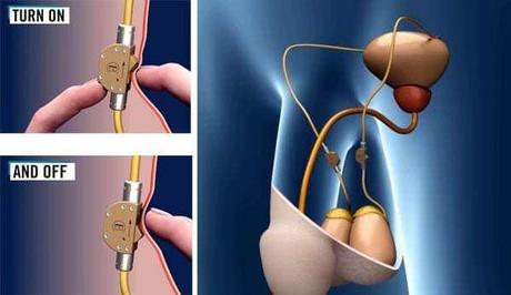 En busca de la píldora anticonceptiva para hombres y otros métodos viables para ellos