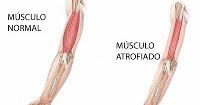 Terapia con Células Madres  para Distrofias Musculares