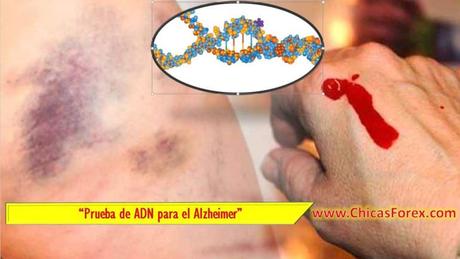 ¿Cómo empieza la leucemia?,

¿Qué examen se hace para saber si tengo leucemia?,

¿Cómo diagnosticar la leucemia en adultos?,

¿Qué es la leucemia y cómo se transmite?,

examen para detectar leucemia adultos,

hemograma leucemia,

que examen se hace para saber si tengo leucemia,

diagnostico de leucemia por laboratorio,

valores de leucocitos en leucemia,

diagnostico de leucemia pdf,

blastos leucemia,

tratamiento para la leucemia