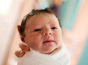 Cianosis: coloración azulada piel bebé