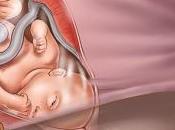 semanas embarazo Noveno