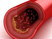 ¿Cuál diferencia entre colesterol LDL?