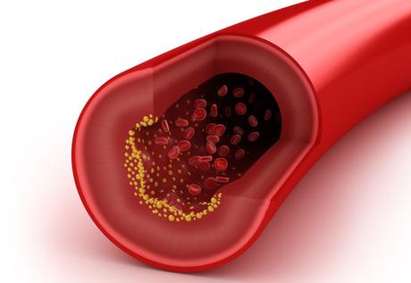 ¿Cuál es la diferencia entre el colesterol HDL y el colesterol LDL?