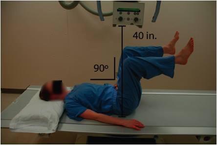 Proyección de Dunn (Dunn view