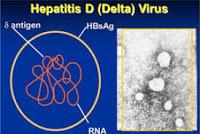 Nuevos Fármacos para Tratar la Hepatitis Delta