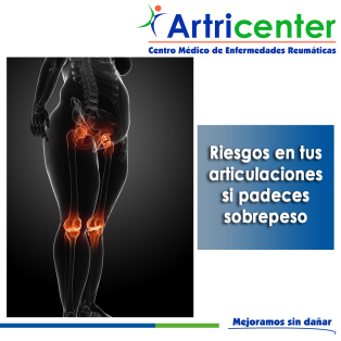 Artricenter: Riesgos en tus articulaciones si padeces sobrepeso