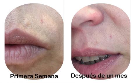 Probando, probando Bio10 forte de Bella Aurora