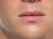 Sobre brotes paperas…