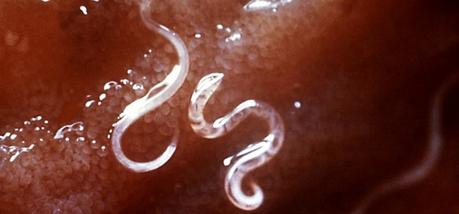 Parásitos intestinales Parásitos en el intestino