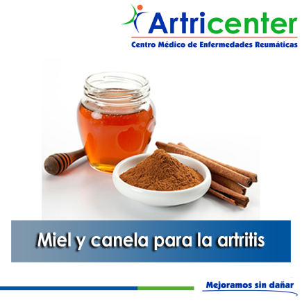 Artricenter: Miel y canela para la artritis