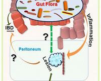 El Metronidazol reduce  las lesiones causadas por la Endometriosis.