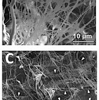 Compuesto de Nanofibra-hidrogel permitira regenerar tejidos blandos