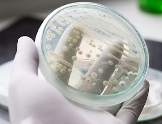 CANDIDA AURIS, UN PATÓGENO EMERGENTE CANDIDA AURIS, UN PATÓGENO EMERGENTE