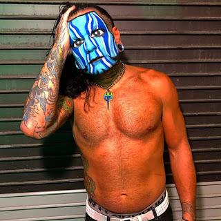 Video de Jeff Hardy después de Cirugia