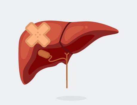 ¿Qué es la fibrosis hepática? ¿Qué es la fibrosis hepática?