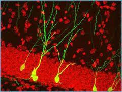 La Depresion y el Estres reducen la Neurogenesis La Depresion y el Estres reducen la Neurogenesis