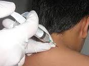 terapia neural
