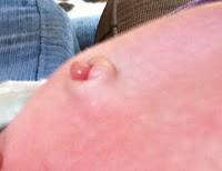 Es un ombligo pero ¿es normal?