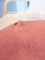 Es un ombligo pero ¿es normal?