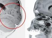 Otro responsable desarrollo nuestro cerebro