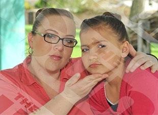 Castigan a la madre que aplicó botox a su hija de ocho años