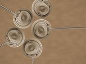 Clínica MarGen Evitan transmisión anomalía renal grave gracias diagnóstico genético preimplantacional embriones