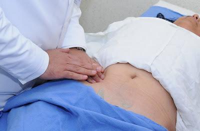 ES CÁNCER DE OVARIO UNA DE LAS PRINCIPALES CAUSAS DE MUERTE EN MUJERES