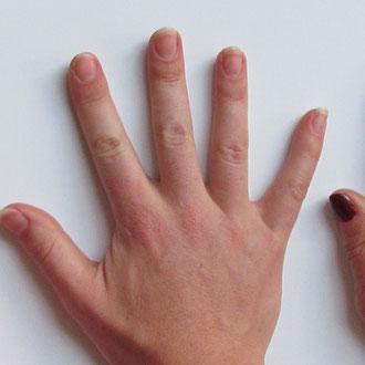 Probióticos. Todos los beneficios para la salud