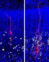 La Severidad del Autismo depende de Células Cerebrales Específicas