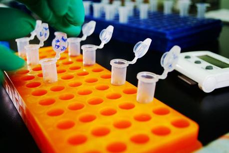 Pruebas de paternidad con ADN Pruebas de paternidad con ADN