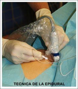 Fidel Pagés Marivé, descubridor de la anestesia epidural