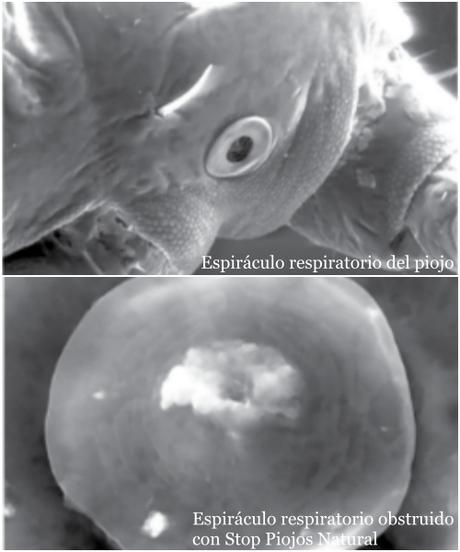 Acaba con los Piojos con la Fórmula Stop Piojos Natural® de Arkopharma