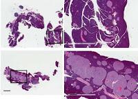 Descubren como hacer que el páncreas produzca más células beta