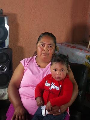 APOYA JAPEM A PEQUEÑA QUE NACIÓ CON UN TUMOR