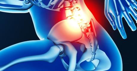 Espondilitis anquilosante Tratamiento de la espondilitis anquilosante