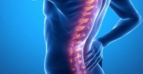 Espondilitis anquilosante Espondilitis anquilosante: síntomas