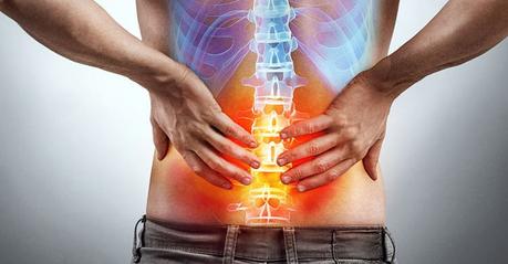 Espondilitis anquilosante ¿Cómo prevenir la espondilitis anquilosante?