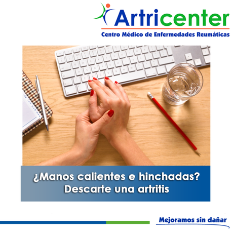 Artricenter: ¿Manos calientes e hinchadas? Descarte una artritis. Artricenter: ¿Manos calientes e hinchadas? Descarte una artritis.