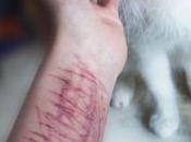 ¿Qué autolesiones? Psicólogos Málaga PsicoAbreu Responde