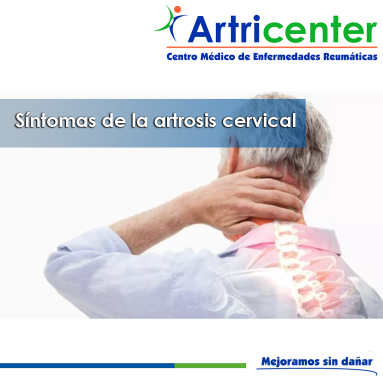 Artricenter: Síntomas de la artrosis cervical Artricenter: Síntomas de la artrosis cervical