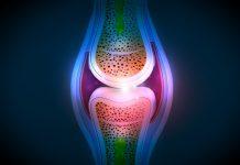 Un médico puede realizar un análisis del líquido sinovial para ayudar a diagnosticar las afecciones de las articulaciones