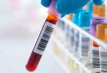 Varios análisis de sangre pueden ayudar a diagnosticar la artritis reumatoide