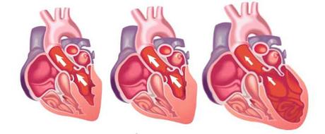 Labios morados Insuficiencia cardíaca