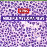 Daratumumab más lenalidomida y dexametasona para el mieloma no tratado.