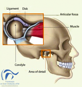 El Dolor Mandibular