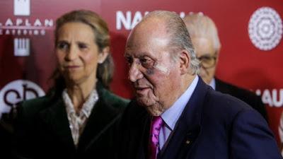 Los claroscuros del rey Juan Carlos I, retirado hoy de la vida pública oficial.