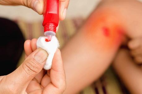 Cómo se curan las heridas de los niños paso a paso