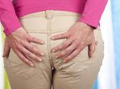 Hemorroides posparto